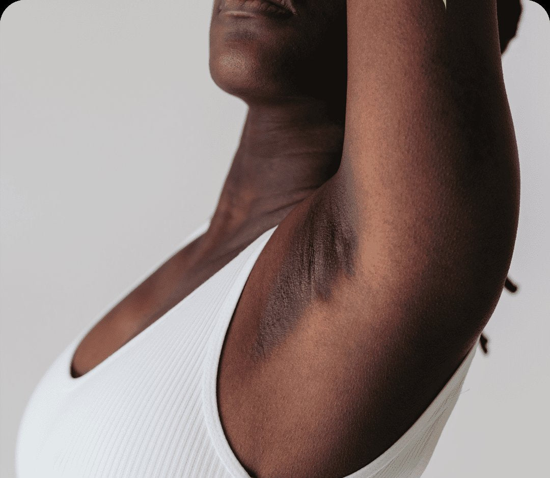 Dark Armpit Collection Image