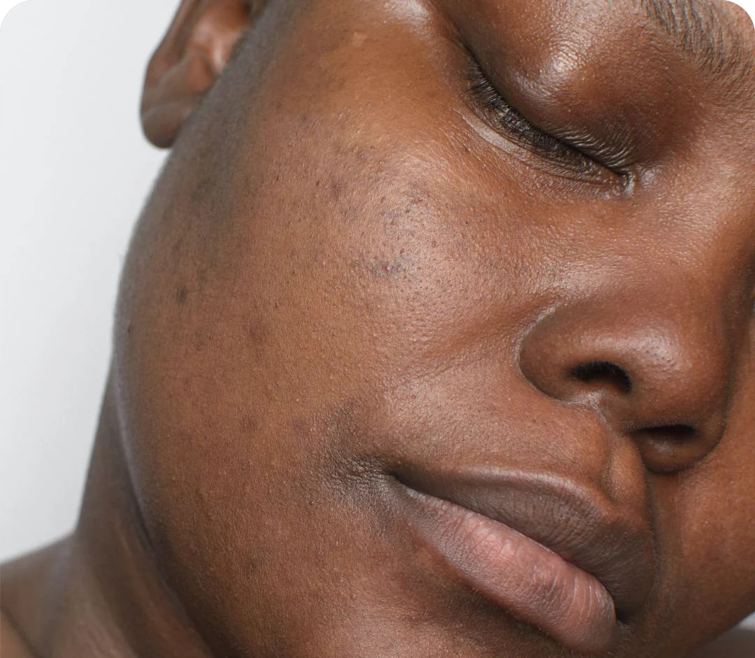 Body Spots Collection Image