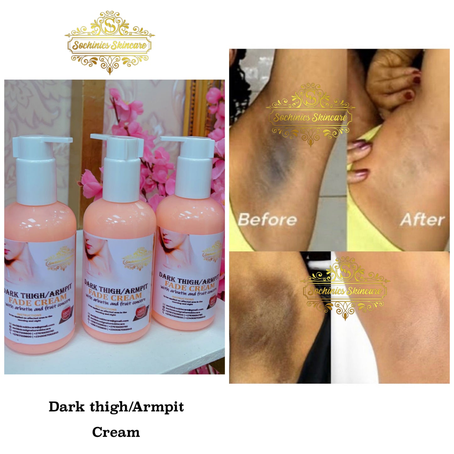 Dark inner thigh/Armpit fade cream 120ml
