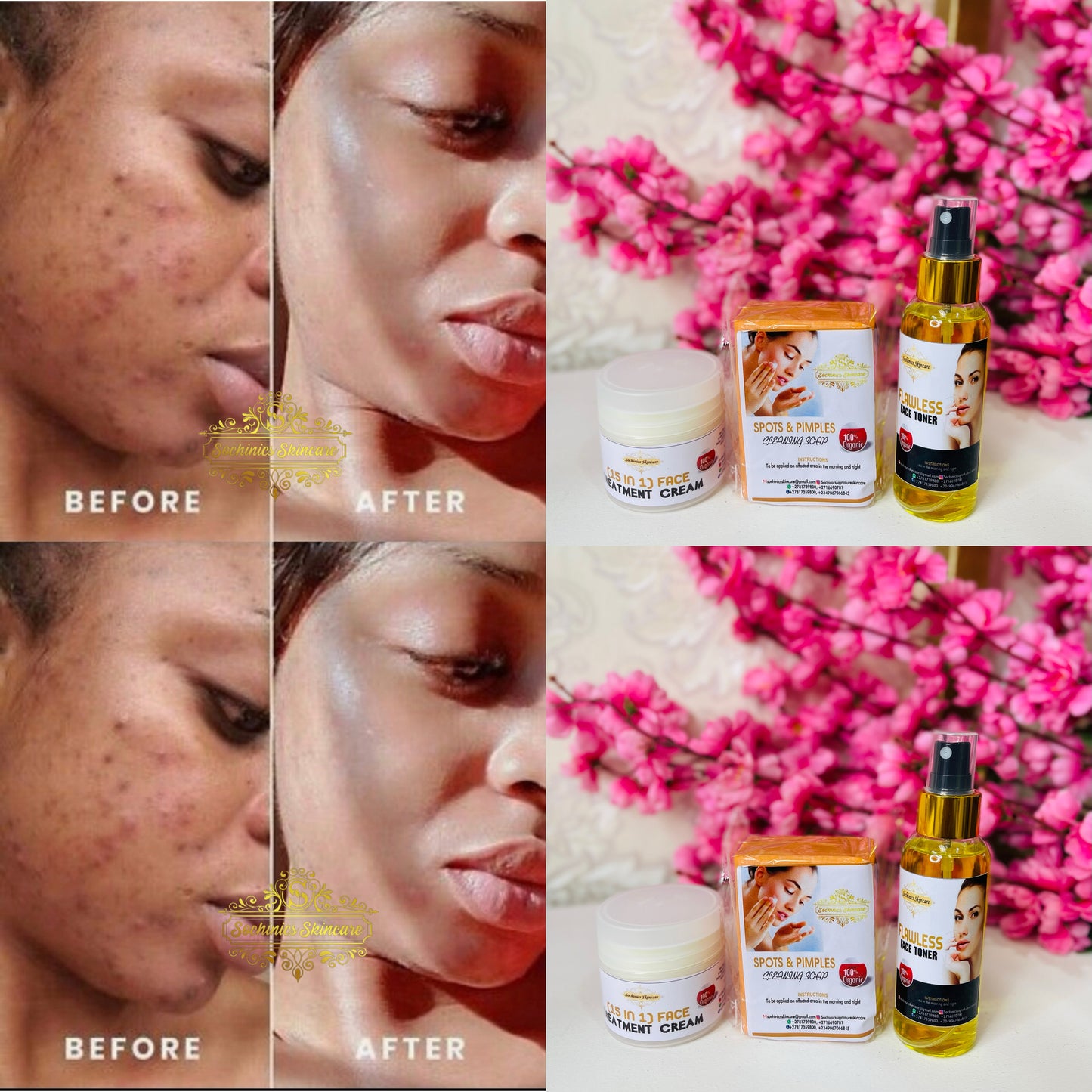 FACE TREATMENT COMBO