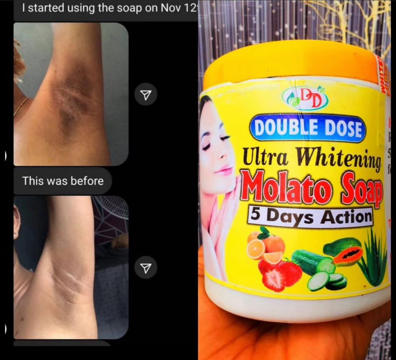 Double Dose Molato Ultra Whitening soap